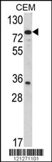 TGM4 Antibody