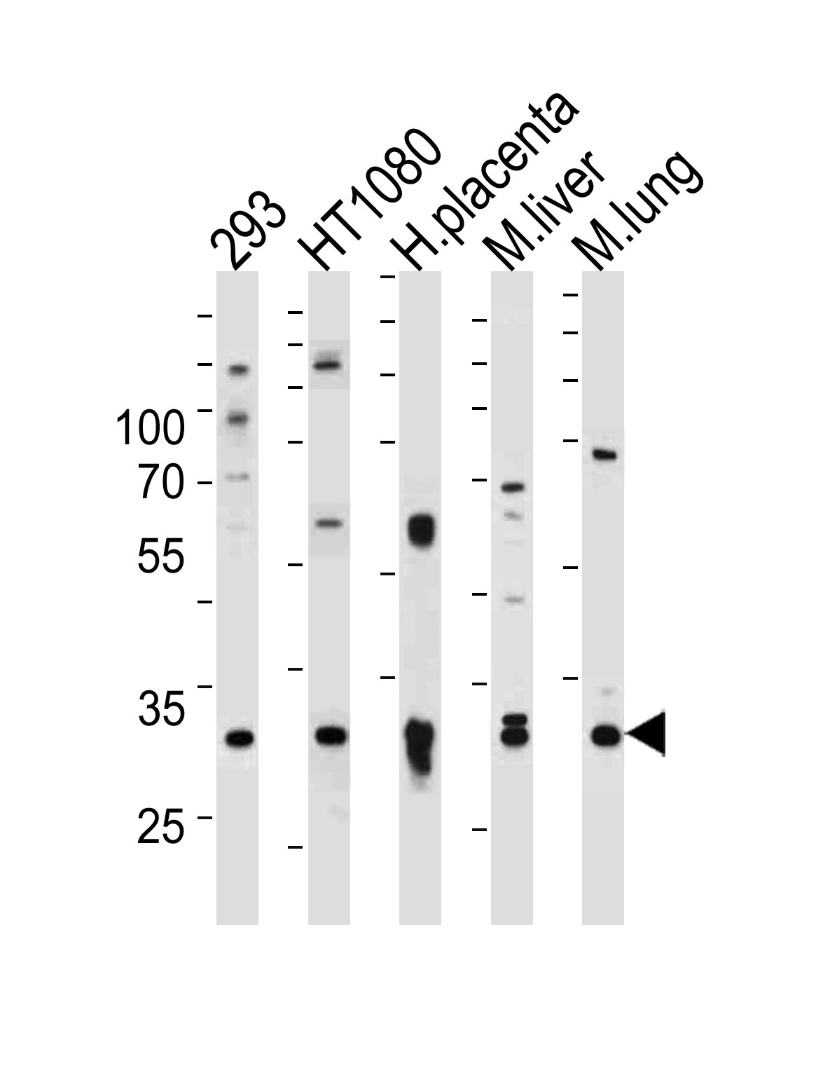 SAR1A Antibody