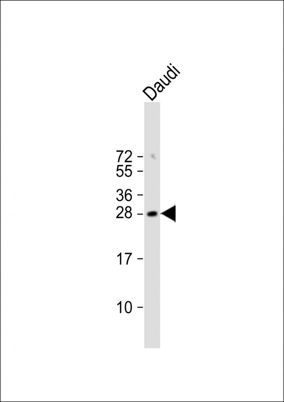 FAM3B Antibody