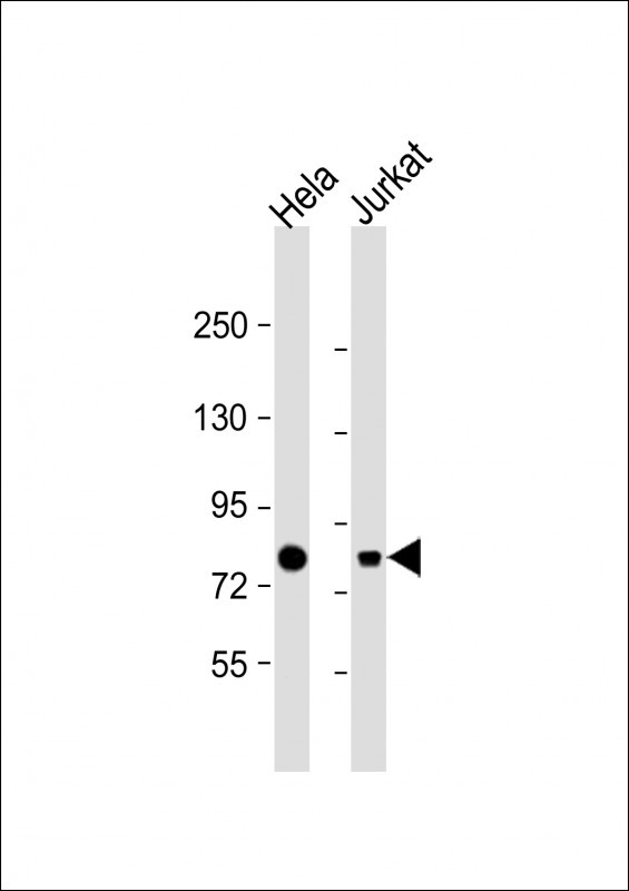 HADHA Antibody