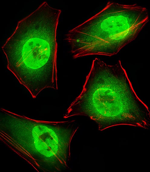 GTF2I Antibody