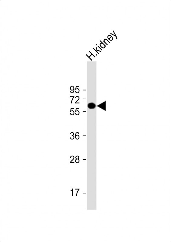 ETFDH Antibody