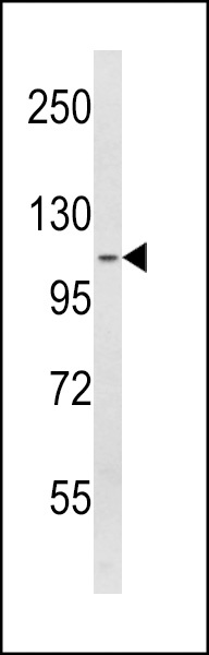 SPINK5 Antibody