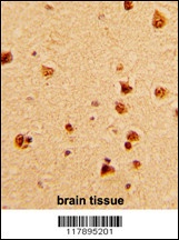 KHSRP Antibody