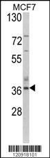 ASPA Antibody