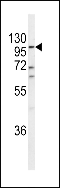 ECE1 Antibody