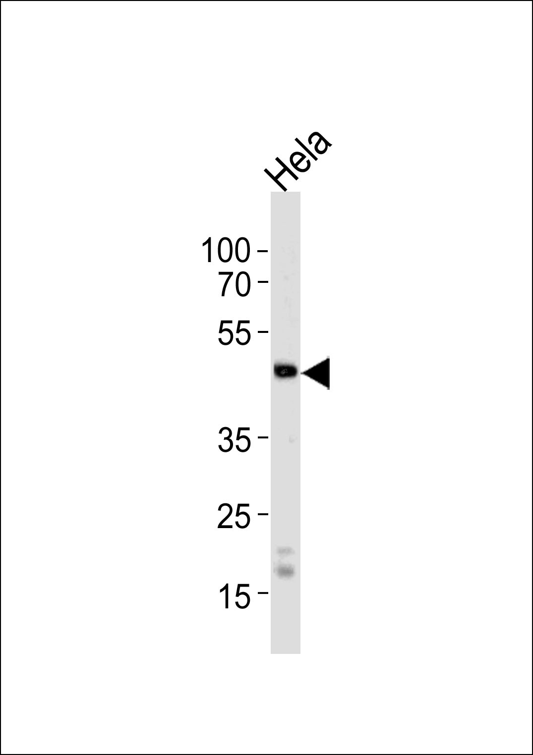 WSB2 Antibody