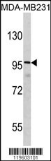 DLGAP1 Antibody