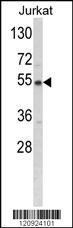 BCKDHA Antibody