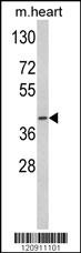 ACADM Antibody