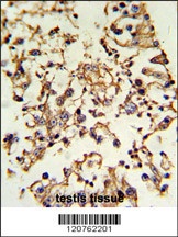 PRKACA Antibody