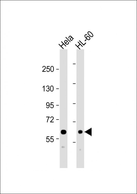 MTM1 Antibody