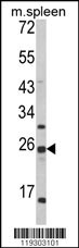 FKBP11 Antibody