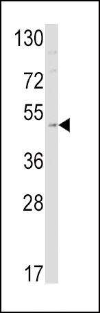 EDNRB Antibody