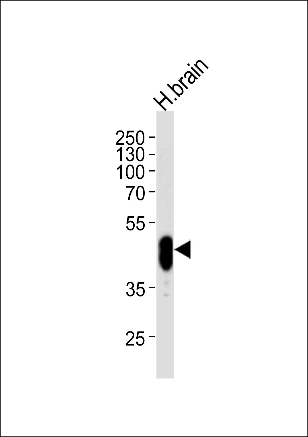 CDK14 Antibody