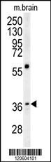 MAPRE1 Antibody