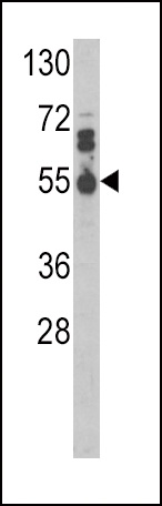 IL17RB Antibody