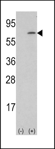 CSF1 Antibody