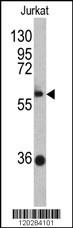 ZBTB2 Antibody