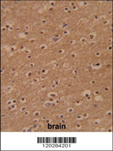 ZBTB2 Antibody