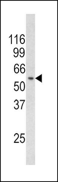 RCBTB2 Antibody