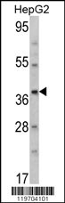 AMT Antibody