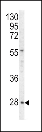 HPRT1 Antibody