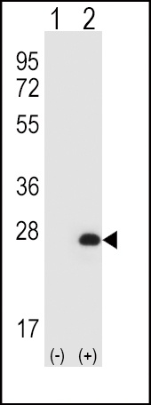 HPRT1 Antibody