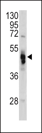 GLA Antibody