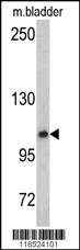 OGT Antibody