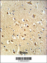 OGT Antibody