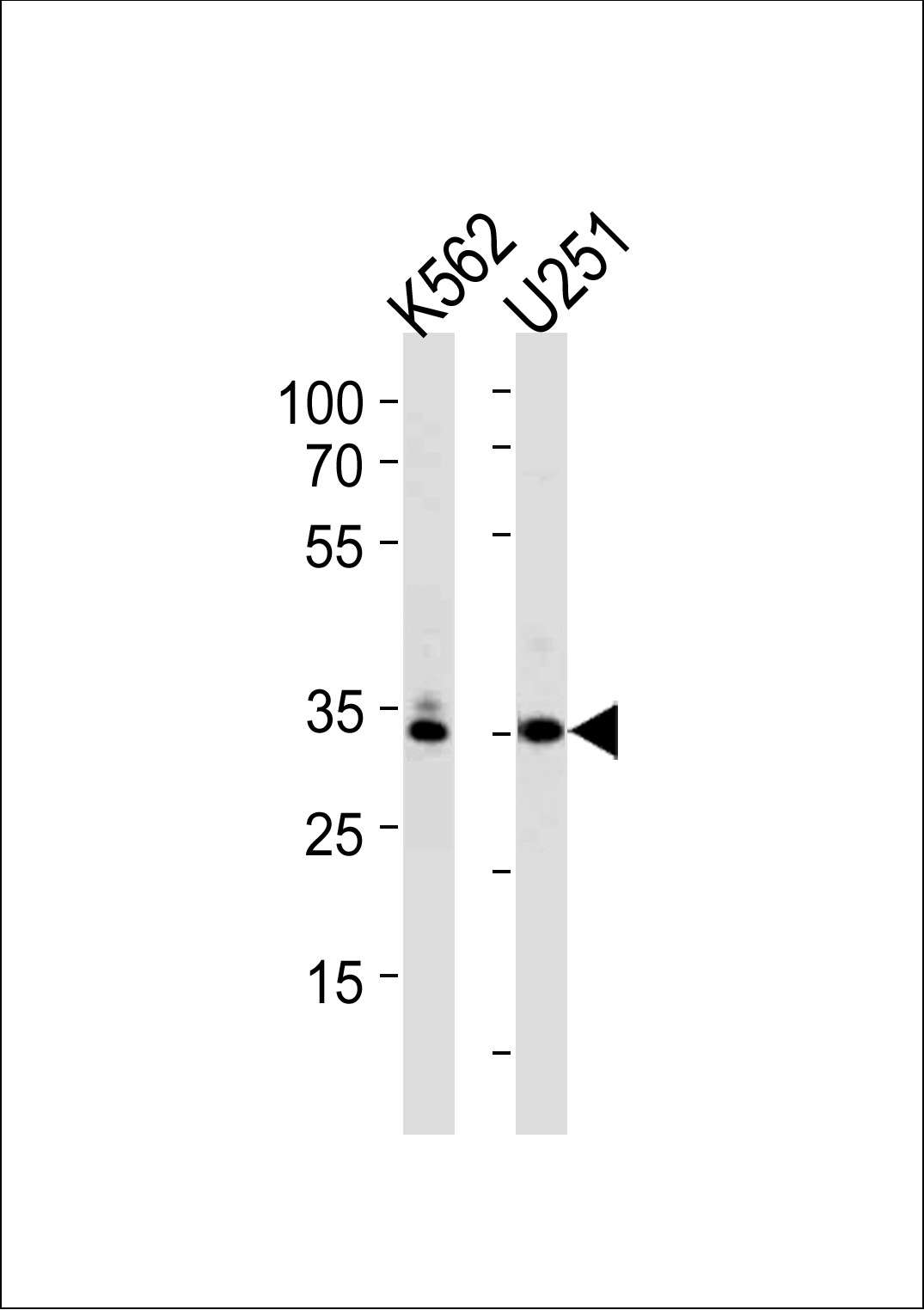 TBP Antibody