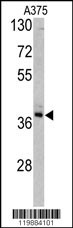 TALDO1 Antibody