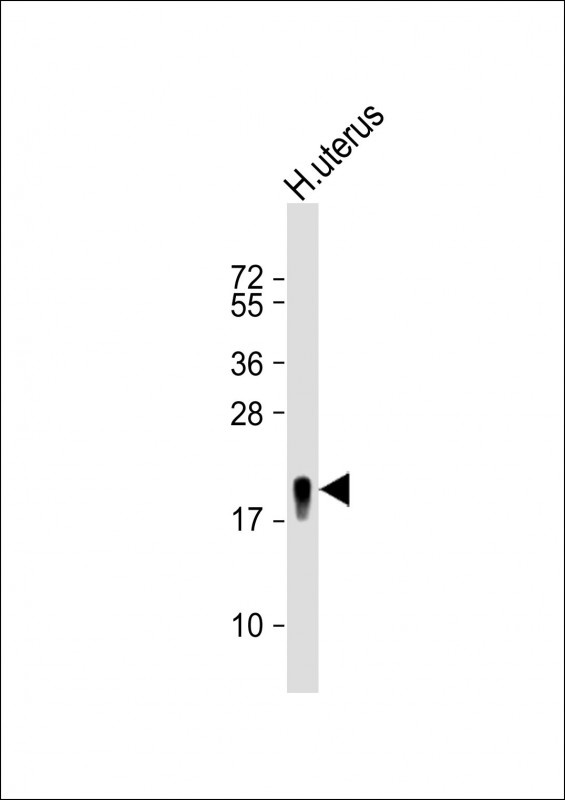 TAGLN Antibody