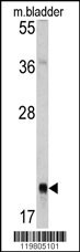 RAB13 Antibody