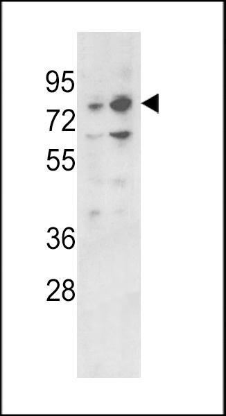 ZBTB16 Antibody