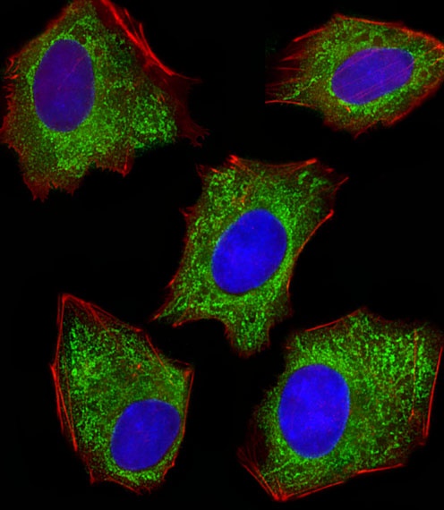 PDIA6 Antibody