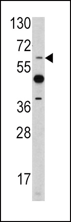 ETV4 Antibody