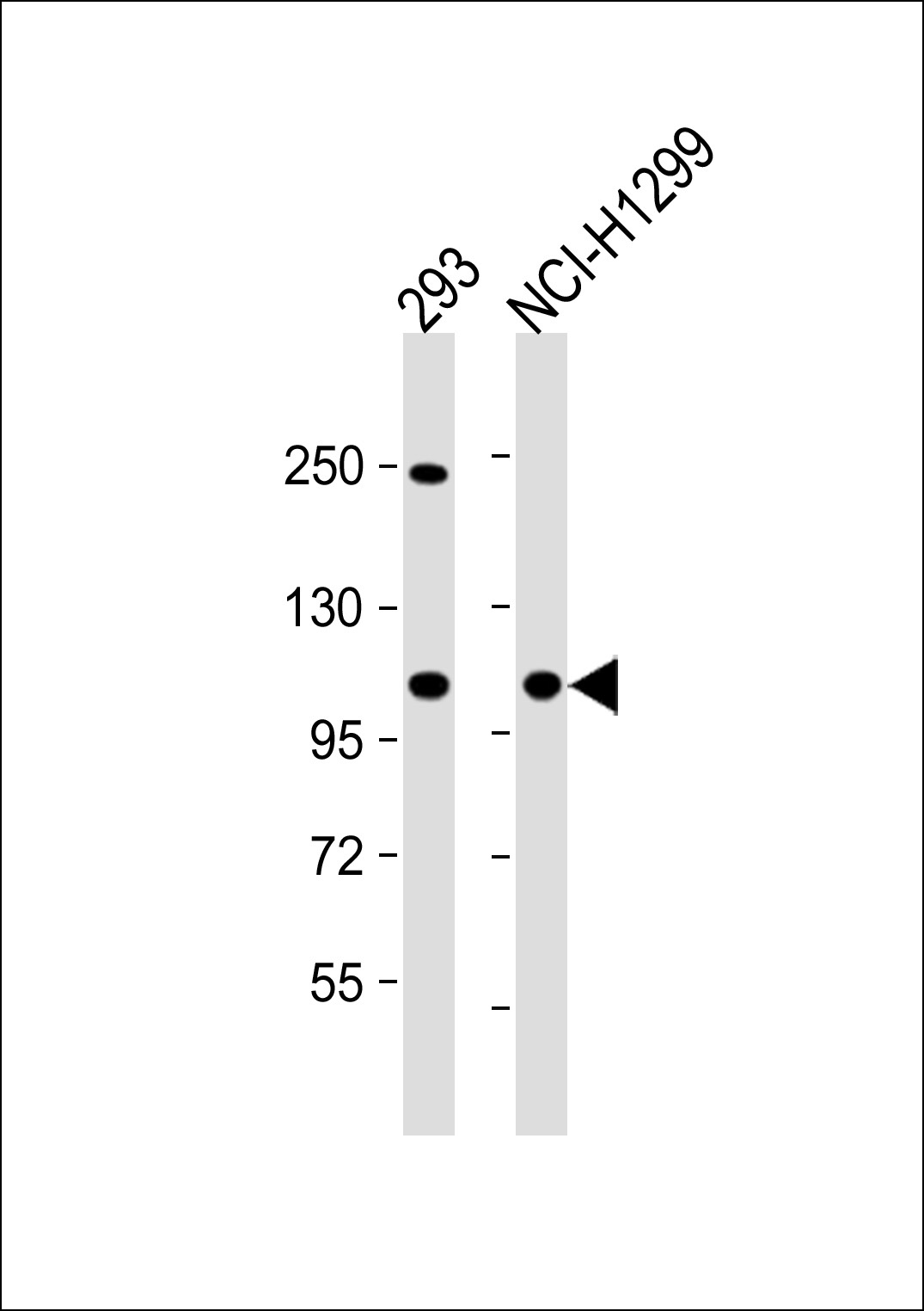 CTDP1 Antibody