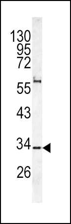CACNG5 Antibody