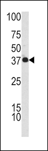CFHL1 Antibody
