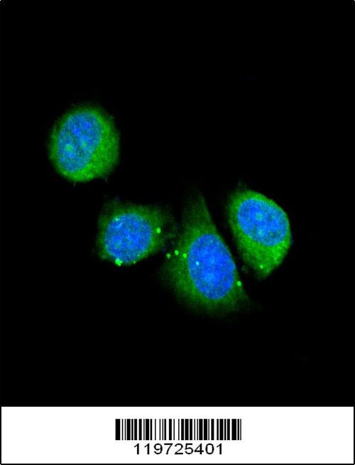 ASPN Antibody