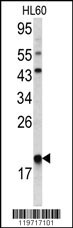 ARPC3 Antibody