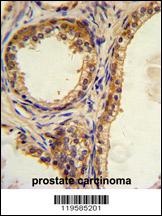 CREB3L1 Antibody
