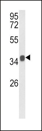 KLF6 Antibody