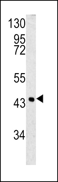 SERPINB3 Antibody