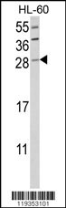 GZMB Antibody