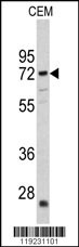 CRAT Antibody