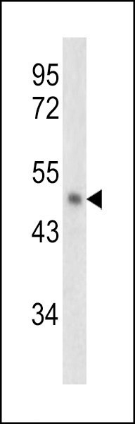 SERPINB2 Antibody