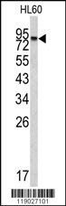 CPXM2 Antibody